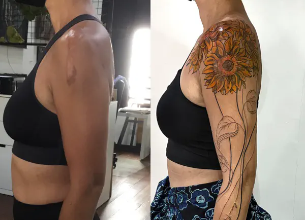 Scar Cover up tattoo